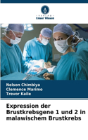 Expression der Brustkrebsgene 1 und 2 in malawischem Brustkrebs