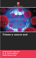 Trismo e cancro oral
