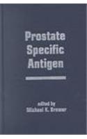 Prostate Specific Antigen