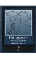 Hysterectomy