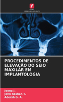 Procedimentos de Elevação Do Seio Maxilar Em Implantologia