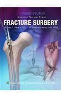 Harborview Illustrated Tips and Tricks in Fracture Surgery