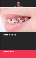 Maloclusão