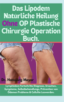 Lipödem Natürliche Heilung Ohne OP Plastische Chirurgie Operation Buch