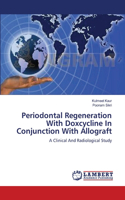 Periodontal Regeneration With Doxcycline In Conjunction With Allograft