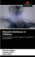 Discoid meniscus in children