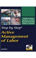 Step by Step: Active Management of Labor