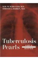 Tuberculosis Pearls: a Practical Guide