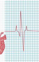 CHD Journey Notebook: Heartbeat Rhythm Waveform, Graph Paper Book, 5 in x 8 in, 50 sheets / 100 pages