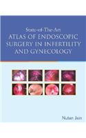 State of the Art Atlas of Endoscopic Surgery in Infertility and Gynecology