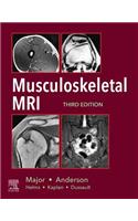 Musculoskeletal MRI E-Book
