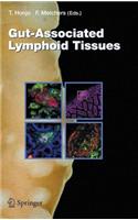 Gut-Associated Lymphoid Tissues