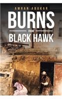 Burns from Black Hawk