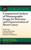 Computerized Analysis of Mammographic Images for Detection and Characterization of Breast Cancer