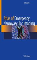 Atlas of Emergency Neurovascular Imaging