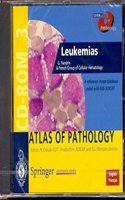 Leukemias
