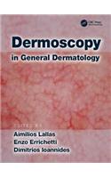 Dermoscopy in General Dermatology