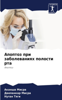 &#1040;&#1087;&#1086;&#1087;&#1090;&#1086;&#1079; &#1087;&#1088;&#1080; &#1079;&#1072;&#1073;&#1086;&#1083;&#1077;&#1074;&#1072;&#1085;&#1080;&#1103;&#1093; &#1087;&#1086;&#1083;&#1086;&#1089;&#1090;&#1080; &#1088;&#1090;&#1072;