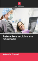 Retenção e recidiva em ortodontia