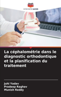 céphalométrie dans le diagnostic orthodontique et la planification du traitement