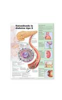 Understanding Type 2 Diabetes Anatomical Chart in Spanish (Comprendiendo la diabetes tipo 2)
