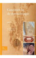 Casuïstiek in de Dermatologie - Deel 2