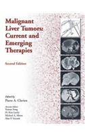 Malignant Liver Tumors: Current and Emerging Therapies