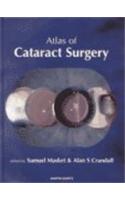 An Atlas of Cataract Surgery