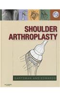 Shoulder Arthroplasty