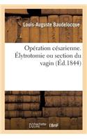 Opération Césarienne. Élytrotomie Ou Section Du Vagin, Précédée, Ou Non, de la Ligature