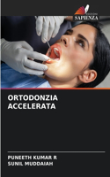 Ortodonzia Accelerata