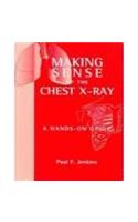 Making Sense of the Chest X-Ray: A Hands on Guide