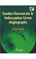 Fundus Fluorescein and Indocyanine Green Angiography