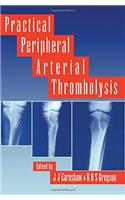 Practical Peripheral Arterial Thrombolysis
