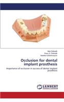 Occlusion for Dental Implant Prosthesis
