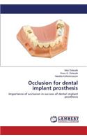 Occlusion for Dental Implant Prosthesis