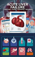 Acute Liver Failure - Symptoms, Causes, Diagnosis, Treatment