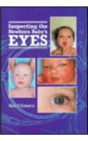 Inspecting the Newborn Baby's Eyes
