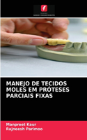 Manejo de Tecidos Moles Em Próteses Parciais Fixas