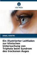 illustrierter Leitfaden zur klinischen Untersuchung von Triphala beim Syndrom des trockenen Auges