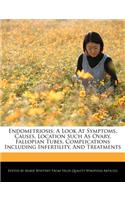 Endometriosis; A Look at Symptoms, Causes, Location Such as Ovary, Fallopian Tubes, Complications Including Infertility, and Treatments