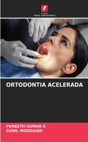 Ortodontia Acelerada
