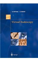 Virtual Endoscopy