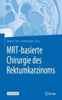 Mrt-Basierte Chirurgie Des Rektumkarzinoms