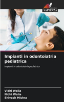 Impianti in odontoiatria pediatrica