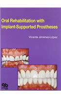 Oral Rehabilitation With Implant-Supported Prostheses
