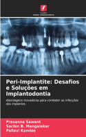 Peri-Implantite