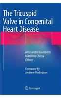 Tricuspid Valve in Congenital Heart Disease