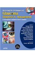 Mastering the Technique of Glaucoma Diagnosis and Its Management