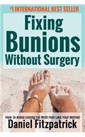 Fixing Bunions Without Surgery